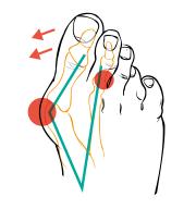 Compressana TAPE SOX Hallux Valgus koriģējošās īkšķa līmlentes zeķes